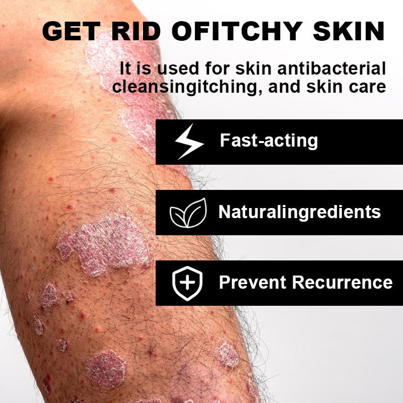 NESLEMY™ Psoriasis Cure Cream, relieves itching and restores smooth and youthful skin