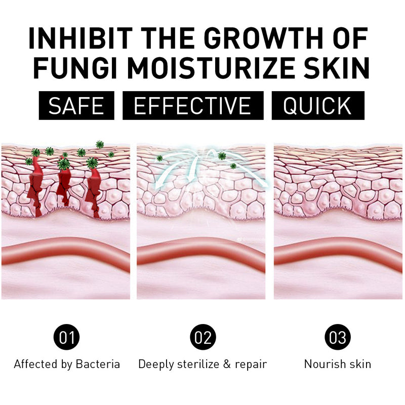 NESLEMY™ Psoriasis Cure Cream, relieves itching and restores smooth and youthful skin