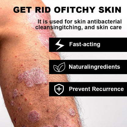 NESLEMY™ Psoriasis Cure Cream, relieves itching and restores smooth and youthful skin