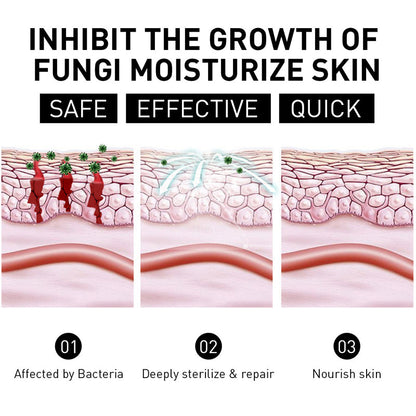 NESLEMY™ Psoriasis Cure Cream, relieves itching and restores smooth and youthful skin
